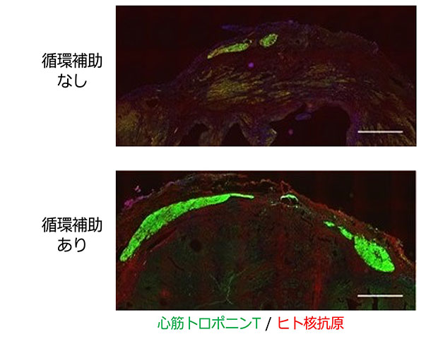 循環補助ありなしで心筋トロポニンTとヒト核抗原の発現を比較した顕微鏡写真