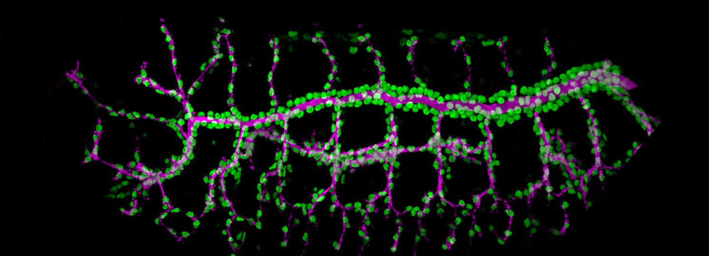 Fly embryo trachea system