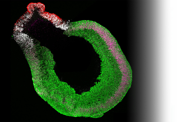 hippocampal organoid