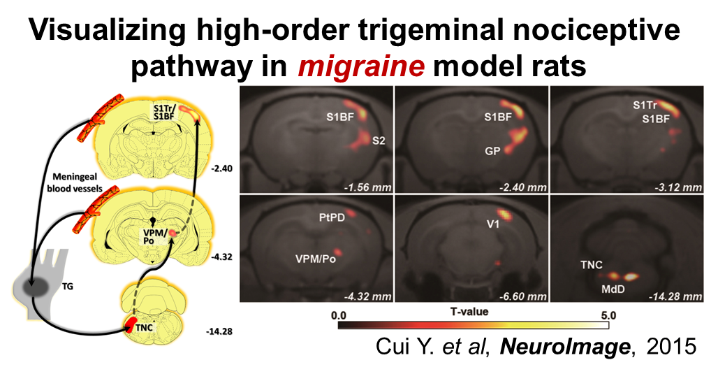 Visualizing high-order trigeminal nociceptive pathway in migraine model rats