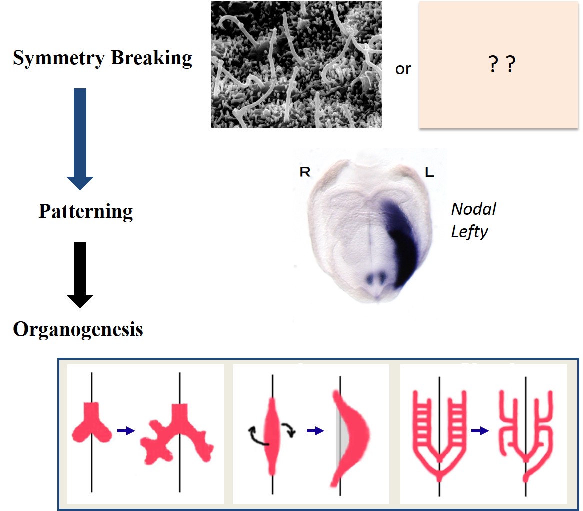 How left-right asymmetry is established in vertebrates